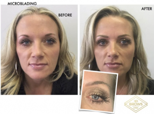 Correcting Bad Permanent Makeup Eyebrows: Strategies & Options in Utah