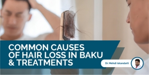 6 Common Causes of Hair Loss in Baku And Treatments