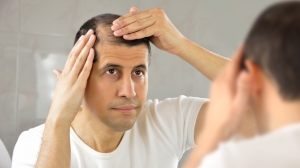 Top Qualities to Look for in a Hair Loss Doctor