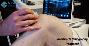 Small Parts Sonography Treatment in Thane