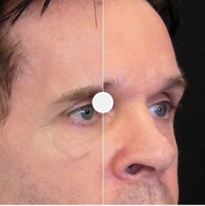 Discover the Excellence: Plastic Surgeon Harley Street at Dr Cotrufo’s London Clinic