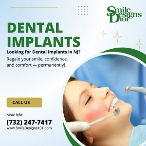 What Are Dental Implants? A Complete Guide for Local Patients