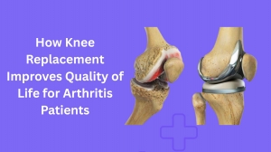 Affordable & Advanced Care with the Best Knee Replacement Surgeon in Jaipur