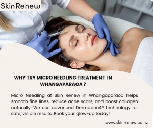 Micro Needling Treatment in Whangaparaoa - Personalized Skin Care at SkinRenew