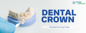 Beyond the Filling: When a Dental Crown is the Real Fix for Your Tooth