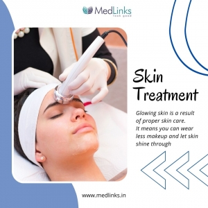 Clear Skin Ahead: Advanced Acne Treatment at MedLinks Aesthetics