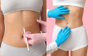 Plastic Surgery Near Me, 7 Expert Services You Can Trust