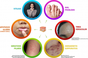 Soothe Eczema Naturally with Holistic Skin Care