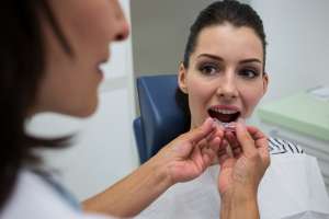 Adult Orthodontics with Crowns or Implants: Make a Plan That Works
