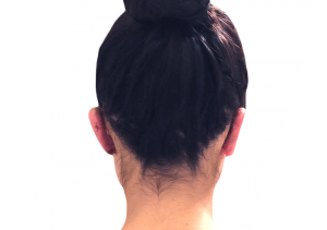 What Can Ear Surgery and a Tummy Tuck in Houston Do for You?