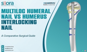 Multiloc Humeral Nail vs Humerus Interlocking Nail: A Comparative Surgical Guide 