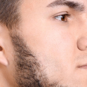 Is Sideburn Hair Transplant Simple to Maintain?