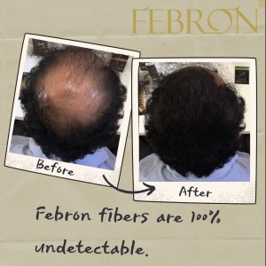 Hair Fibers For Women: Trusted Non-Surgical Solution To Thinning Hair