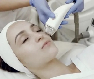 Safe and Effective Melasma Treatment in Islamabad