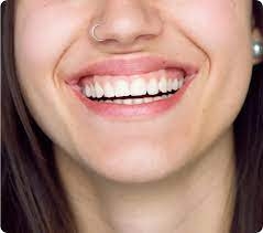 Who Is a Good Candidate for Gum Contouring?