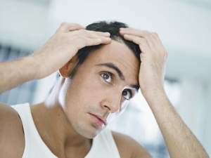Does Hybrid Hair Transplant Work for Thin Hair?