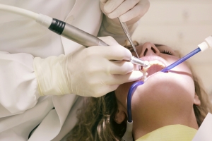 Restore Your Smile with Tooth Colored Fillings in Washington, DC.