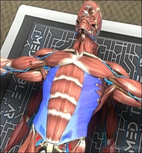Surgical Plans Falling Apart? Use 3D Full Body Anatomy Instead
