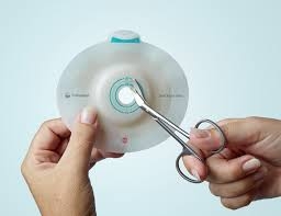 Ostomy Devices Market Opportunities Driven by Rising Number of Surgical Procedures and Increasing Patient Awareness