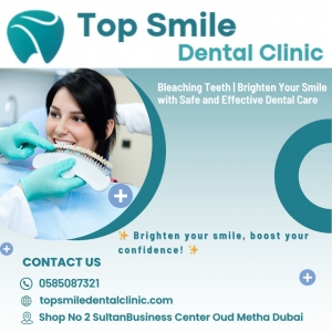 Professional Bleaching Teeth Treatment in Dubai – Top Smile Dental Clinic
