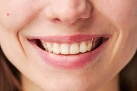 Can Dental Stain Removal Help with Yellow Teeth?
