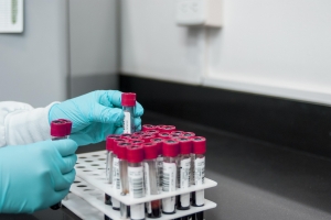 The Path of Experimental Drugs Toward Market Approval