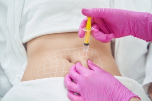 Fat Melting Injection Success Stories from Islamabad