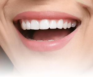 Is Hollywood Smile Design Permanent?