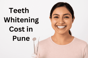 Everything You Need to Know About Teeth Whitening Cost in Pune