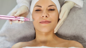 Who’s Microneedling For? Age, Skin, Conditions & More