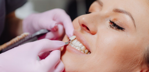 How Dental Veneers Transform Your Smile in Fair Oaks, VA