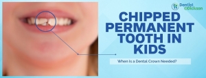 Chipped Permanent Tooth in Kids: When Is a Dental Crown Needed?