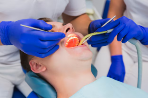 Root Canals in Oxnard: What an Endodontist Can Do for You