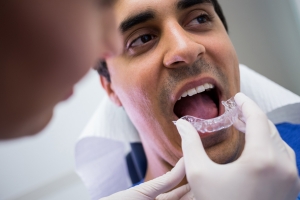 Can Invisible Braces Fix Complex Dental Issues? Here’s What You Should Know