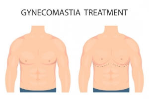 Managing hormones and weight before surgery Islamabad’s guidelines
