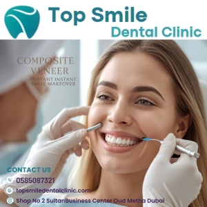 Transform Your Smile Instantly with Composite Veneers in Dubai