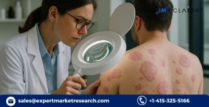 What is Plaque Psoriasis and Why is Pipeline Analysis Important?