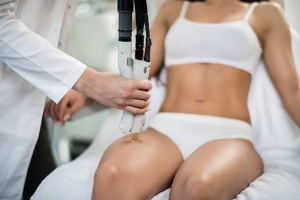 How to Maintain Smooth Skin After Electrolysis Hair Removal in Riyadh