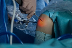 Joint Pain Relief Made Easy – Expert Arthroscopy Surgery in Delhi