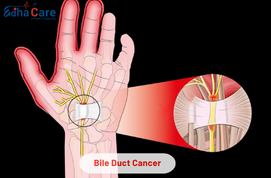 Carpal Tunnel Release Surgery with Edhacare
