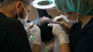 Unlocking Confidence: The Current Market View and Guide to Choosing the best hair transplant in Mumbai