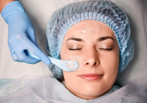 Rejuvenate Your Skin: The Benefits of Chemical Peel