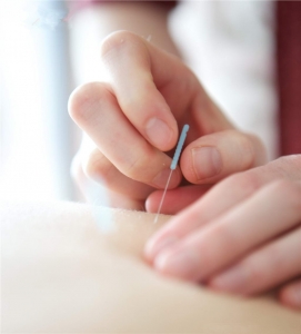 Struggling With Back Pain? Could Acupuncture Be the Solution?