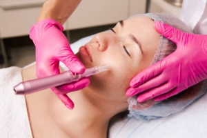 Microneedling in Newport Beach: Revitalize Your Skin Naturally