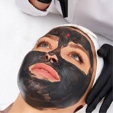 What to Expect During a Spectra Laser Carbon Peeling Session?
