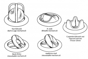Prosthetic Heart Valves Market Positioned for Success Amid Growing Focus on Preventive Cardiology Solutions