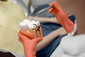 Restoring Teeth with Precision: Exploring Dental Inlays in Westport