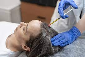 From Root to Renewal: Stem Cell Hair Restoration by Dr. Fazeela Abbasi in Dubai