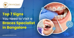 Top 7 Signs You Need to Visit a Braces Specialist in Bangalore