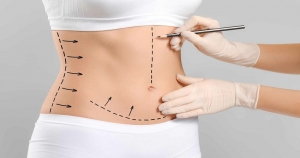 How Soon Will You See Results After Liposuction?